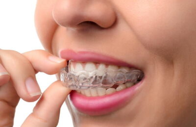 Straighten Your Smile, Unnoticed: Invisalign Clear Aligners